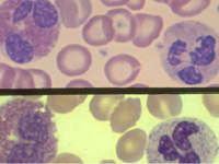 Different types of White Blood Cells